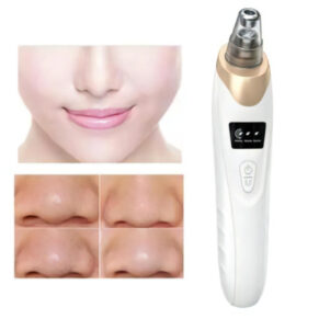 5 in 1 Electric Blackhead Acne Oil Remover